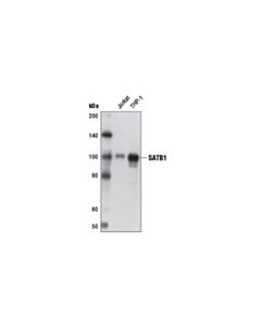 Cell Signaling Satb1 (D41g7) Rabbit mAb