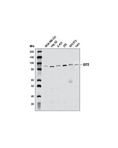 Cell Signaling GIT2 (D11B8) Rabbit mAb 20 uL