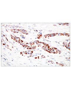 Cell Signaling TFAM (D5C8) Rabbit mAb 20 uL
