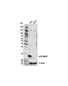 Cell Signaling P16 Ink4a (D7c1m) Rabbit mAb