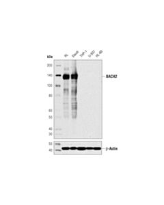Cell Signaling BACH2 (D3T3G) Rabbit mAb 20 uL