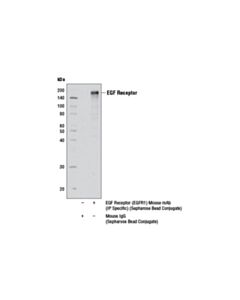 Cell Signaling Egf Receptor (Egfr1) Mouse mAb (Sepharose Bead Conjugate)