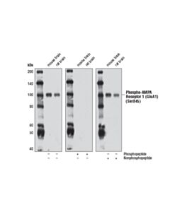 Cell Signaling Phospho-Ampa Receptor 1 (Glua1) (Ser845) (D10g5) Rabbit mAb