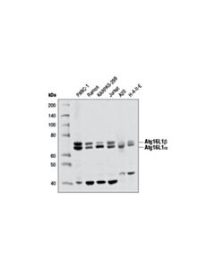 Cell Signaling Atg16l1 (D6d5) Rabbit mAb