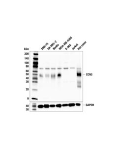 Cell Signaling CCN3 (F1I3E) Rabbit mAb