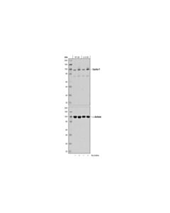 Cell Signaling Cyclin F (D9k2u) Rabbit mAb