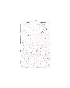 Cell Signaling Signalstain Proliferation/Apoptosis Ihc Sampler Kit