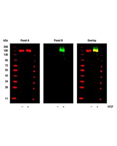 Cell Signaling Signalstain Phospho-Erbb Family Ihc Sampler Kit