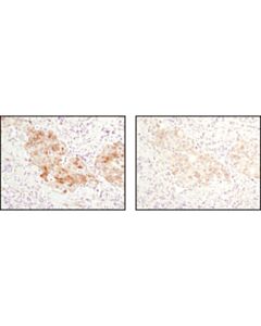 Cell Signaling Signalstain Antibody Diluent