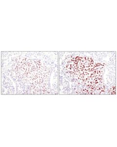 Cell Signaling Signalstain Boost Ihc Detection Reagent (Hrp, Rabbit)