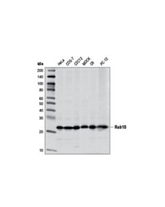 Cell Signaling Rab10 (D36c4) Xp Rabbit mAb