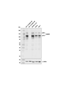 Cell Signaling Adar1 (E6x9r) Xp Rabbit mAb