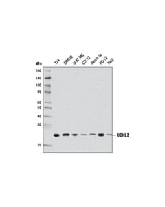Cell Signaling Uchl3 (D25e6) Rabbit mAb