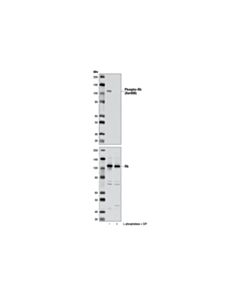 Cell Signaling Phospho-Rb (Ser608) (D10f2) Rabbit mAb