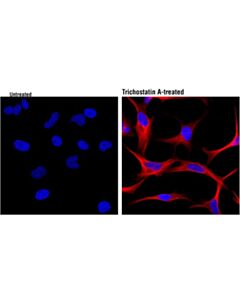 Cell Signaling Acetyl-Alpha-Tubulin (Lys40) (D20g3) Xp Rabbit mAb (Alexa Fluor 647 Conjugate)