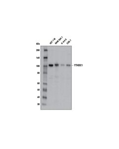 Cell Signaling Ythdc1 (E2p2i) Rabbit mAb