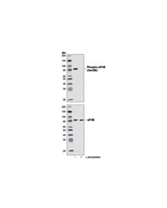 Cell Signaling Phospho-Eif4b (Ser406) (D1c10) Rabbit mAb