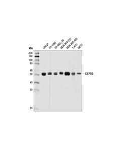Cell Signaling Cep55 (D1l4h) Rabbit mAb