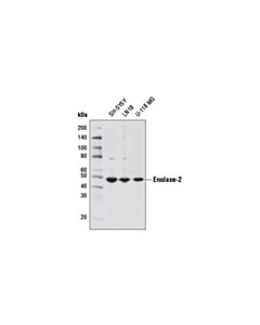 Cell Signaling Enolase-2 (D20h2) Rabbit mAb