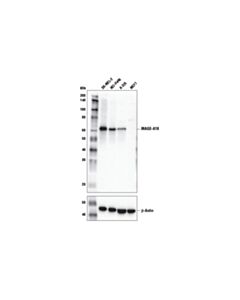 Cell Signaling MAGE-A10 (E9V2Q) Rabbit mAb 20 uL