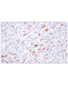 Cell Signaling Cyclin A2 (E9q5g) Rabbit mAb