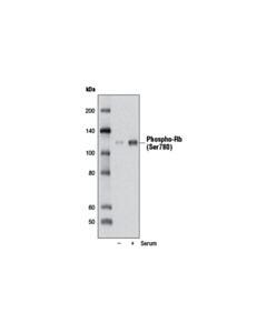 Cell Signaling Phospho-Rb (Ser780) (D59b7) Rabbit mAb