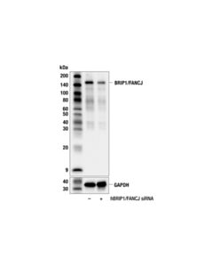 Cell Signaling BRIP1/FANCJ (F4I9N) Rabbit mAb; 20 µl