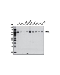 Cell Signaling PKD2 (D1A7) Rabbit mAb 20 uL