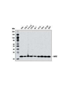 Cell Signaling Hip2 (D27c4) Rabbit mAb