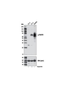 Cell Signaling P75ntr (D4b3) Xp Rabbit mAb