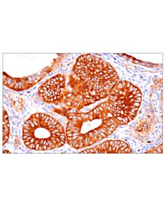 Cell Signaling Nf-Kappab P65 (D14e12) Xp Rabbit mAb