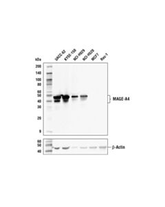 Cell Signaling Mage-A4 (E7o1u) Xp Rabbit mAb