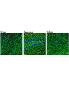 Cell Signaling Phosphoplus Tau (Ser404) Antibody Duet