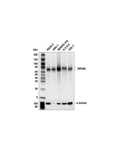 Cell Signaling ZNF384 (F2C1R) Rabbit mAb; 20 µl