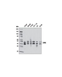 Cell Signaling DR5 (D4E9) XP ® Rabbit mAb (BSA and Azide Free)