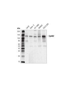 Cell Signaling Ephb2 (D2x2i) Rabbit mAb