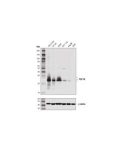 Cell Signaling FGF19 (D1N3R) Rabbit mAb 20 uL