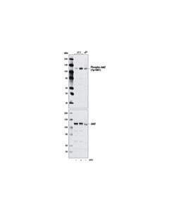 Cell Signaling Alk Activation Antibody Sampler Kit