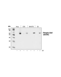 Cell Signaling UV Induced Dna Damage Response Antibody Sampler Kit