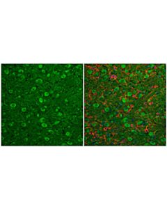 Cell Signaling Lc3b (E5q2k) Mouse mAb