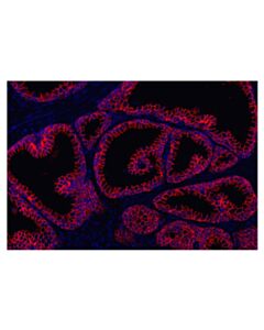 Cell Signaling beta-Catenin (D10A8) Rabbit Monoclonal Antibody (Alexa Fluor® 555 Conjugate)