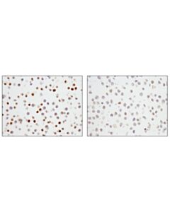 Cell Signaling p27 Kip1 (SX53G8.5) Mouse mAb (IHC Formulated) 20 uL