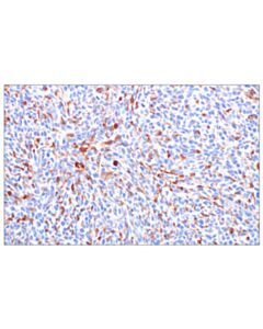 Cell Signaling CSF-1R/M-CSF-R (F1H1I) Rabbit Monoclonal Antibody