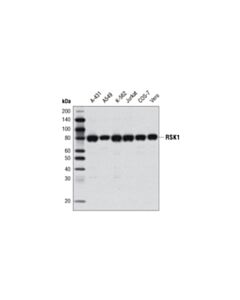 Cell Signaling RSK1 (D6D5) Rabbit mAb 20 uL