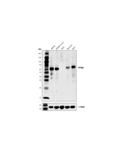 Cell Signaling N-Myc (D1V2A) Rabbit mAb 20 uL