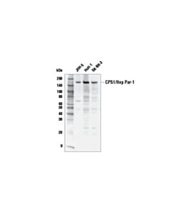 Cell Signaling Cps1 Antibody