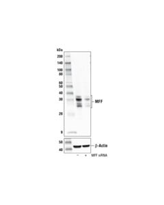 Cell Signaling Mff (E5w4m) Xp Rabbit mAb