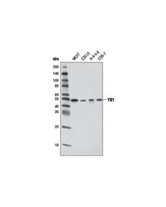 Cell Signaling YB1 (D2B12) Rabbit mAb 20 uL