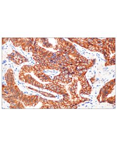 Cell Signaling beta-Catenin (D10A8) Rabbit Monoclonal Antibody