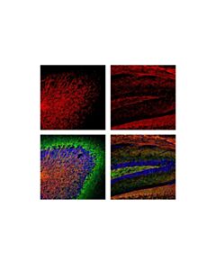 Cell Signaling Myelin Basic Protein (D8x4q) Xp Rabbit mAb (Alexa Fluor 555 Conjugate)